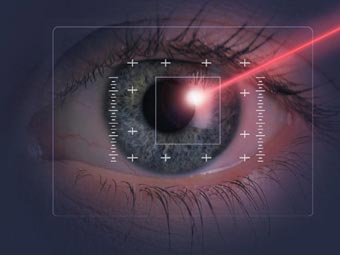 Laser w ludzkim oku?